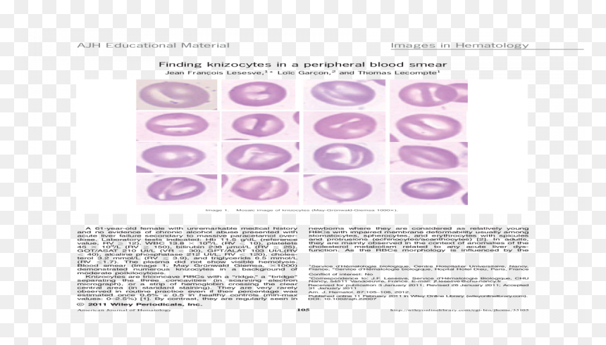 Eye Shadow, HD Png Download - blood smear png