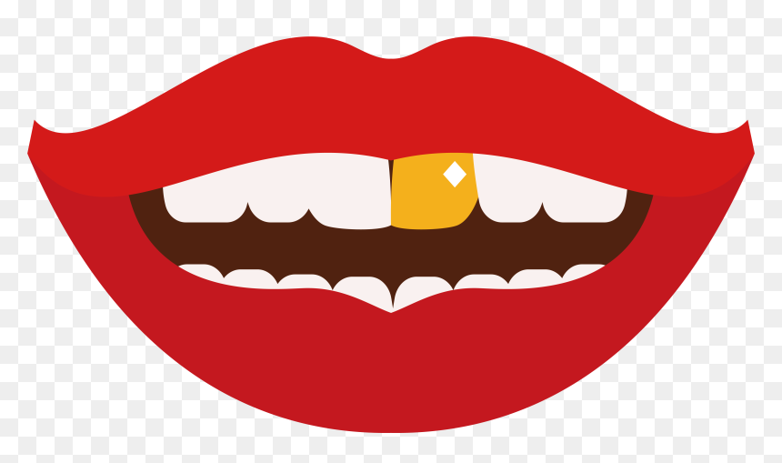 Tooth Gold Teeth Clip Art - Marrakesh, HD Png Download - gold teeth png