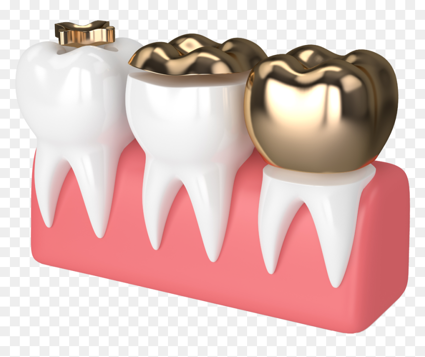 3d Rendering, HD Png Download - gold teeth png