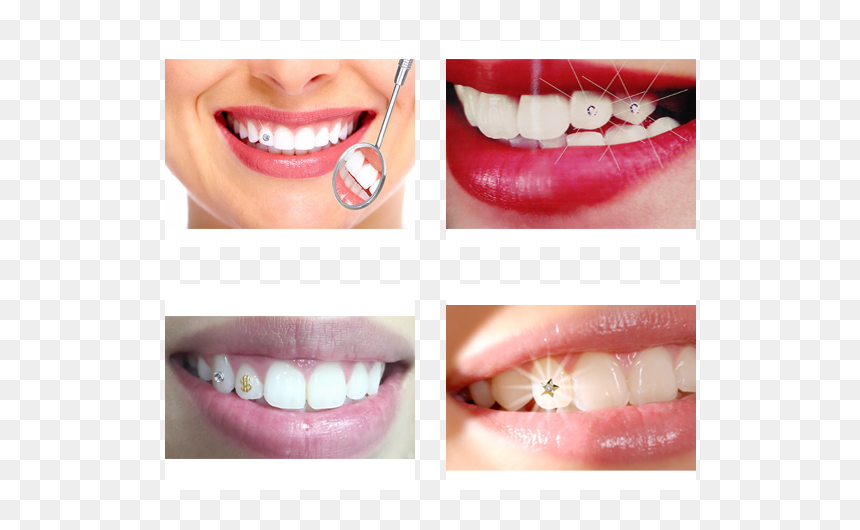 Beautiful Lips, HD Png Download - gold teeth png