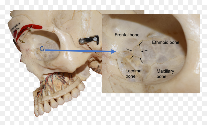 Lacrimal Bone Real Skull, HD Png Download - skull and crossbones png transparent background