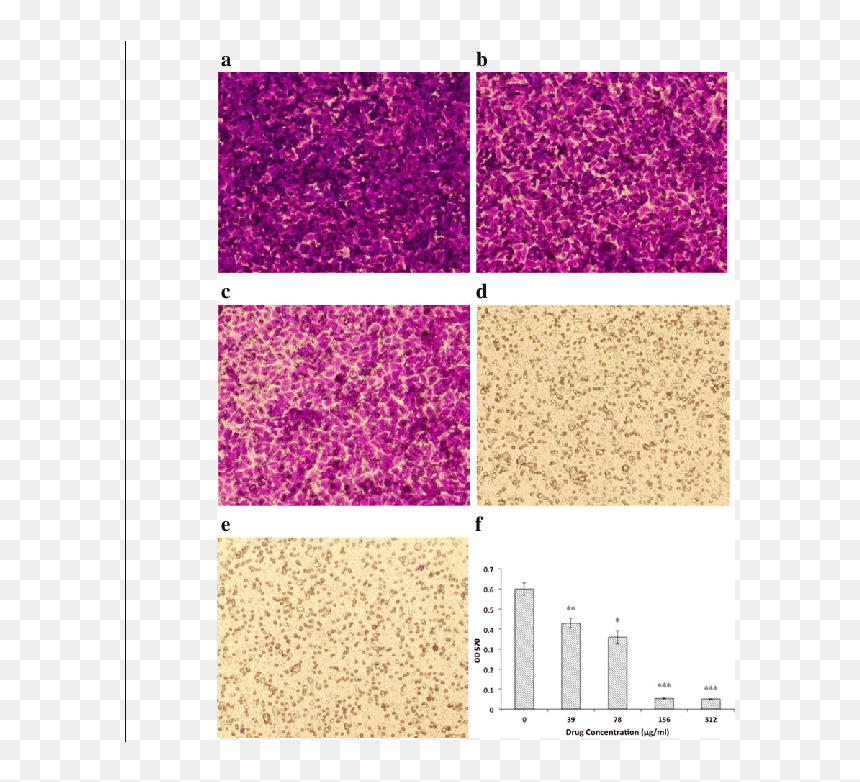 Effect Of Oridonin On Huvec Migration - Glitter, HD Png Download - glitter effect png