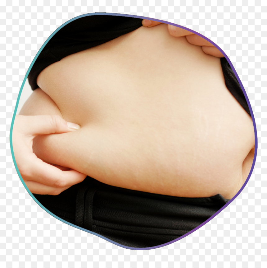 Body-fat , Png Download - Love Handles, Transparent Png - fat png