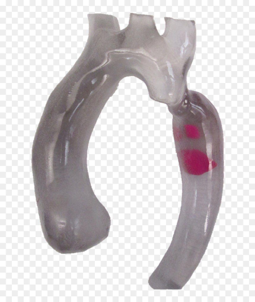 3d Printed Aortic Arch With Thrombus - Diagonal Pliers, HD Png Download - arch png