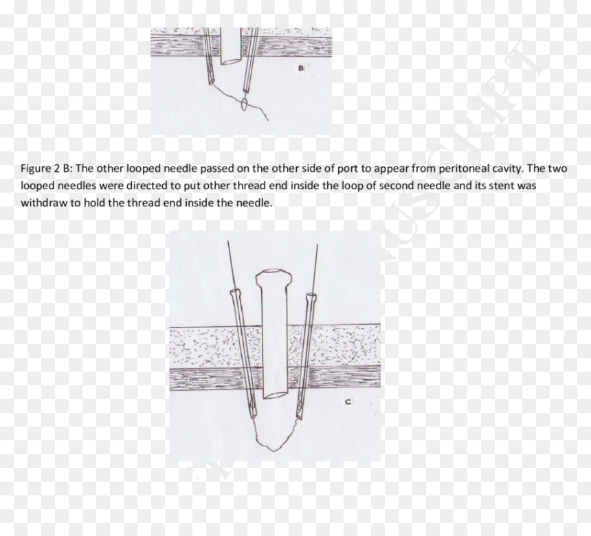 Diagram, HD Png Download - needle and thread png