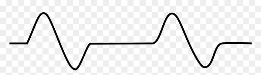 Pulseless Electrical Activity Drawing, HD Png Download - ekg png
