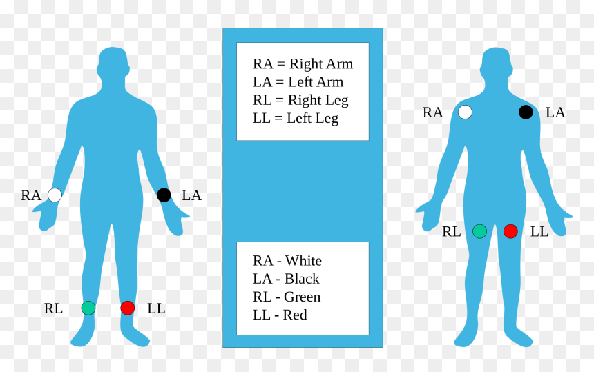 Ra Rl V Ll La, HD Png Download - ekg png