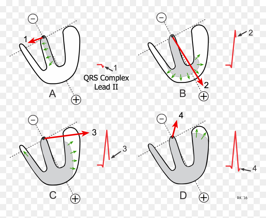 Generation Of Qrs Complex - Heart Depolarization, HD Png Download - ekg png