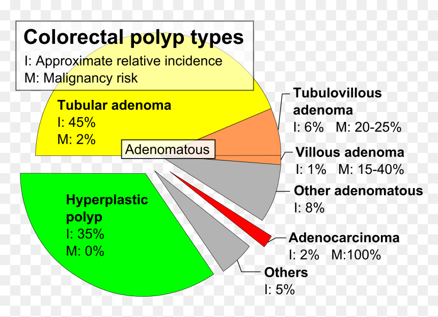 Pie Chart Of Colorectal Polyp Etiologies - Colon Polyp Type, HD Png Download - ram ji png