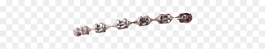 #braces #bracesmile #teeth #tooth #metal #steel #wire - Transparent Png Wires Braces, Png Download - braces png