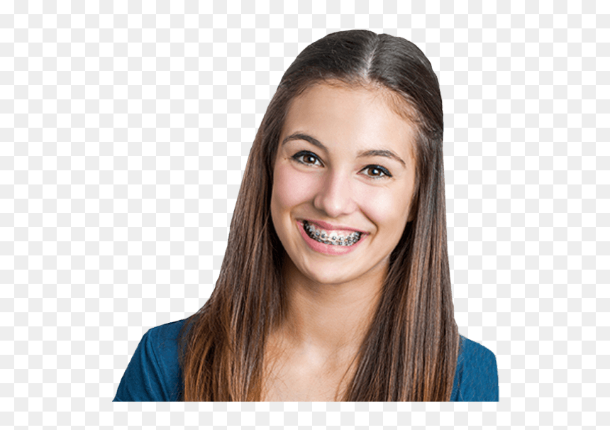Itero Digital Scanner In Manassas Va - Orthodontics Patient, HD Png Download - braces png