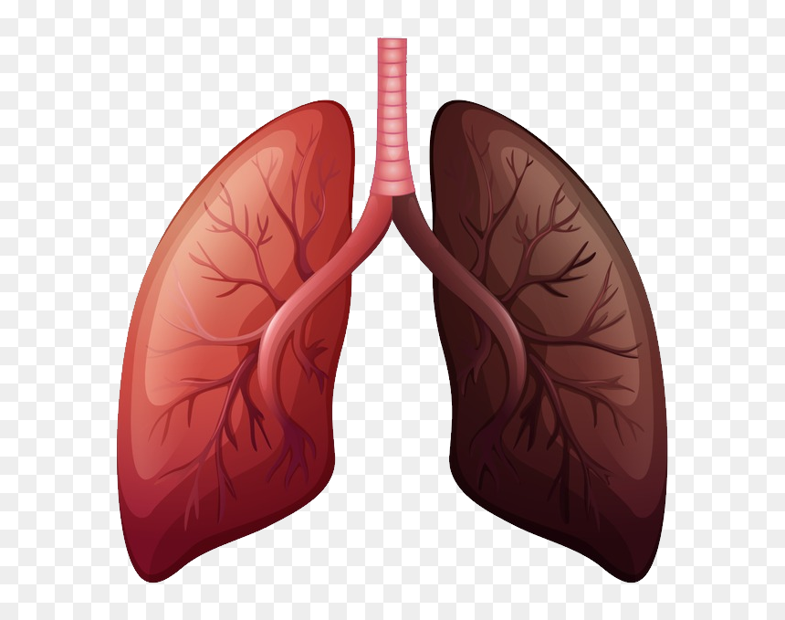 Lung Cancer Before And After Clipart , Png Download - Lungs With Lung Cancer, Transparent Png - lungs png