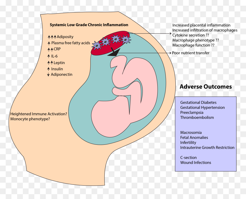 Transparent Fetus Png - Portable Network Graphics, Png Download - fetus png
