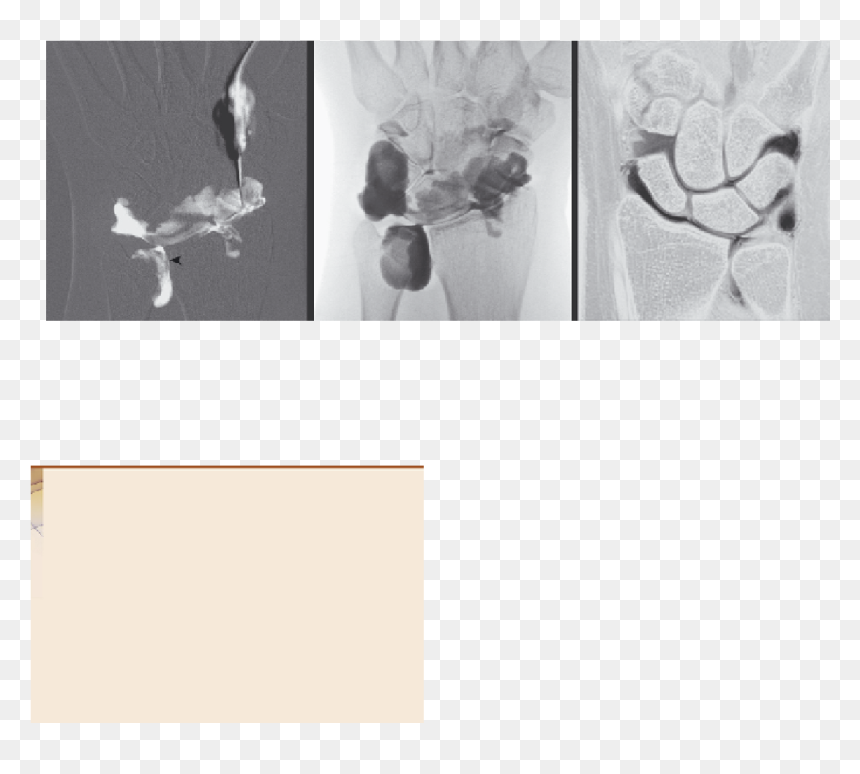 Visual Arts, HD Png Download - page tear png