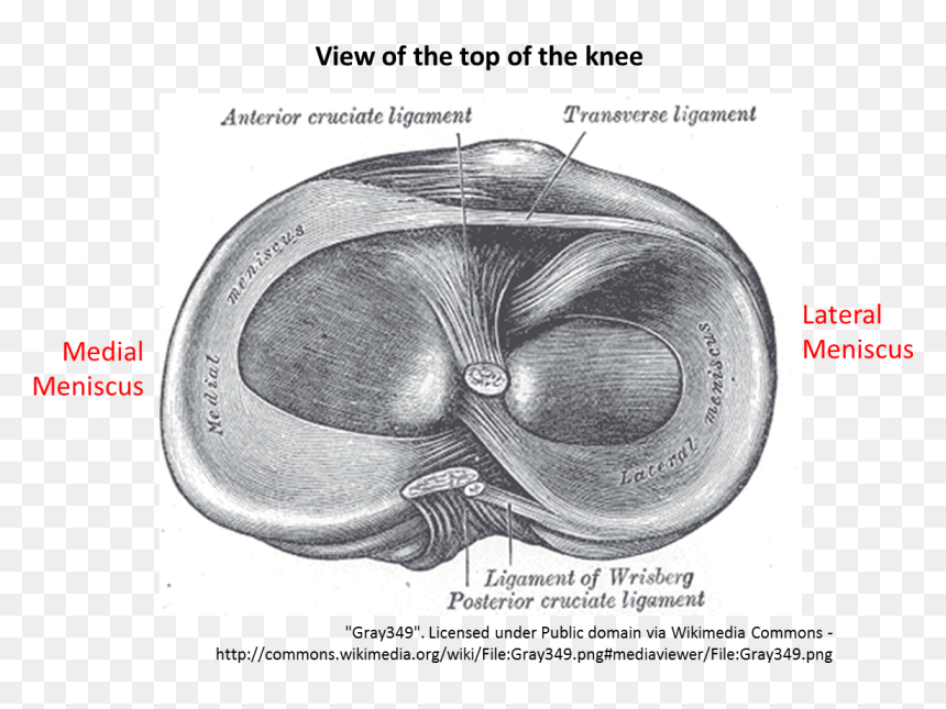 Intra Articular Extra Articular Ligament, HD Png Download - page tear png