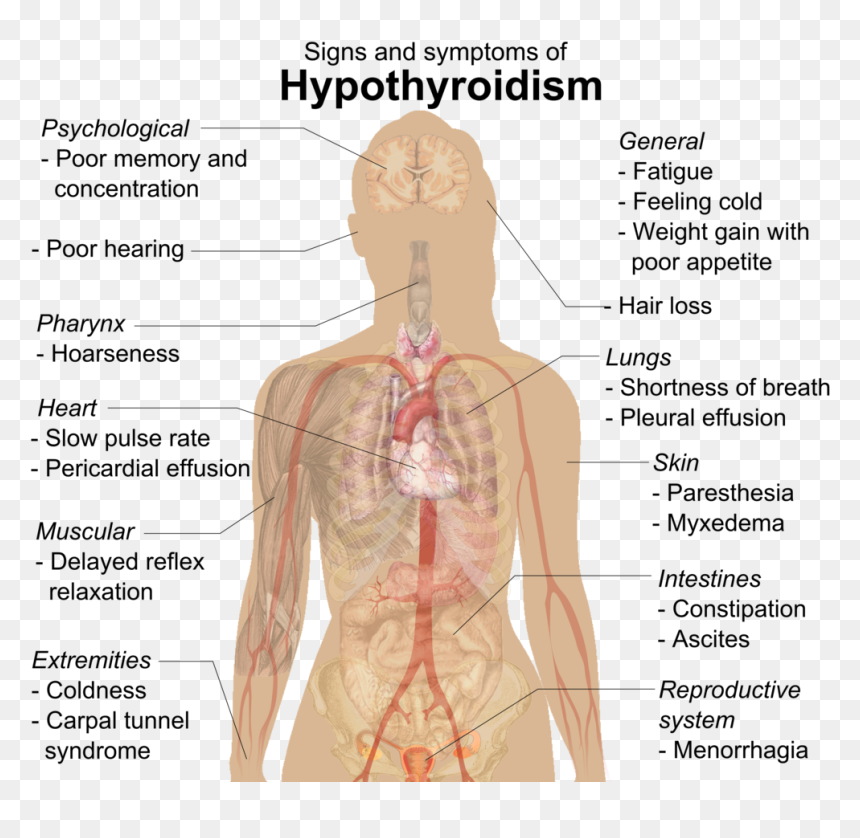 Hypothyroidism Signs, HD Png Download - signs png
