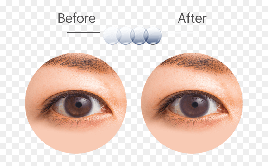 Oasys Transition Eyediagram - Acuvue Oasys With Transitions, HD Png Download - eyes lens png