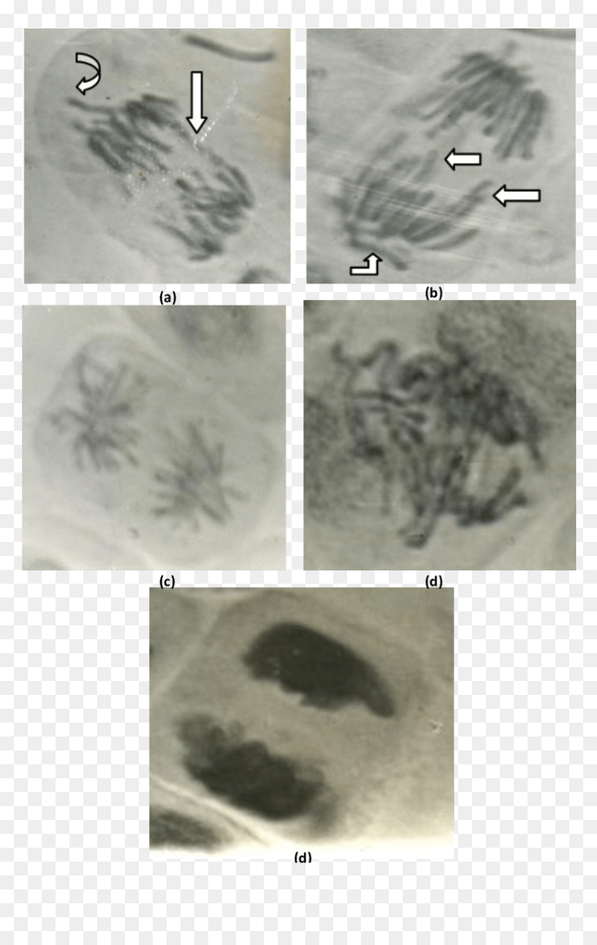 Abnormal Anaphase Cells Showing - Anaphasee Abnormalities, HD Png Download - chromosome png