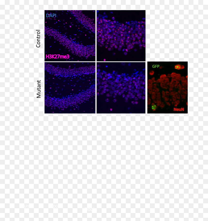 Graphic Design, HD Png Download - chromosome png