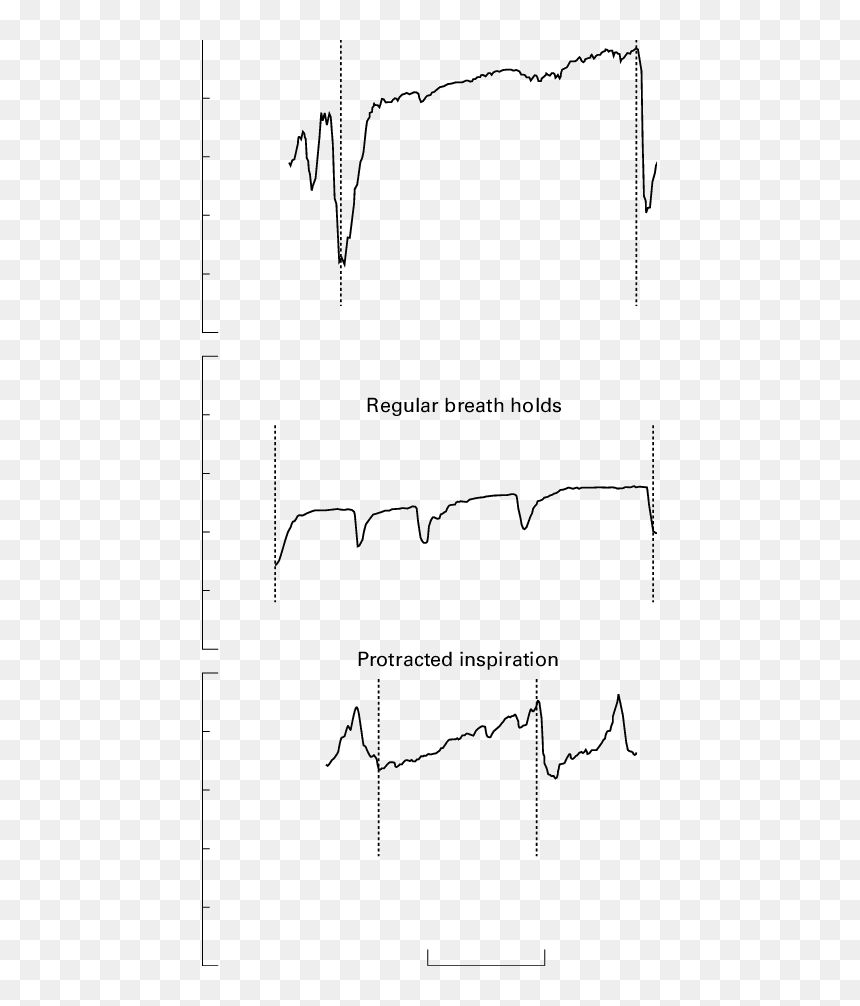 Diagram, HD Png Download - breath png