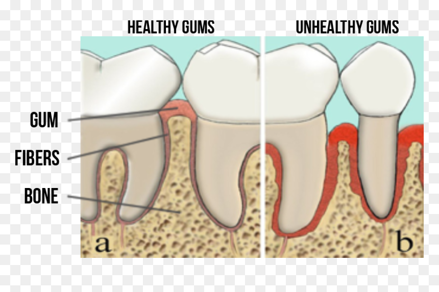 Tongue, HD Png Download - buck teeth png