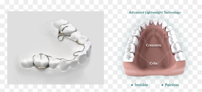 Alf - Cosmetic Dentistry, HD Png Download - buck teeth png