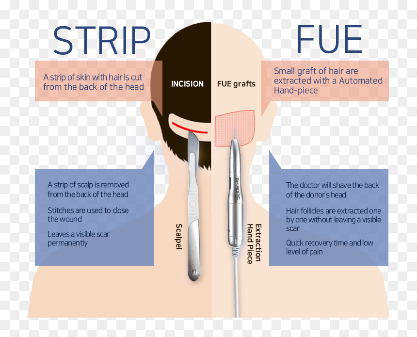 Flyer, HD Png Download - scalpel png