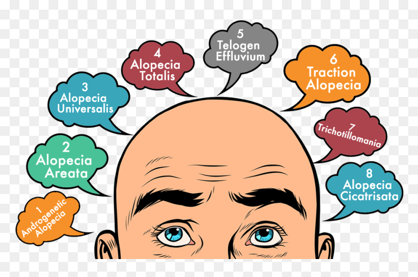 Types Of Hair Loss You Must Learn About - Man With Bald Hair Cartoon, HD Png Download - bald head png