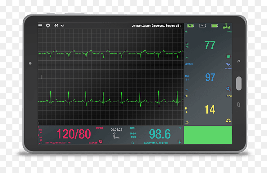 Vios Monitor - Screen, HD Png Download - moniter png
