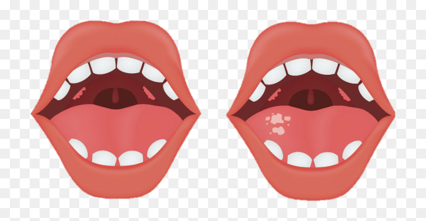 Bad Breath, HD Png Download - boca png