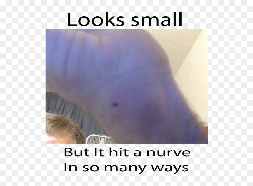 Ouch - Photo Caption, HD Png Download - ouch png
