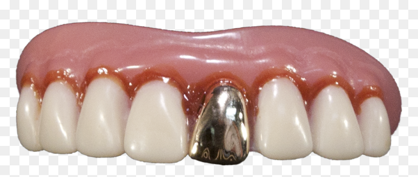 Dental Images High Resolution, HD Png Download - grillz png