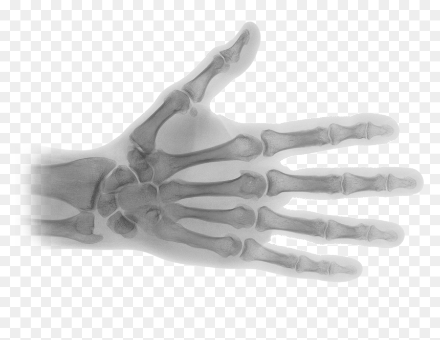 X Ray Image Png, Transparent Png - skeleton hand png