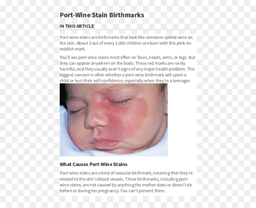 Brochure, HD Png Download - wine stain png