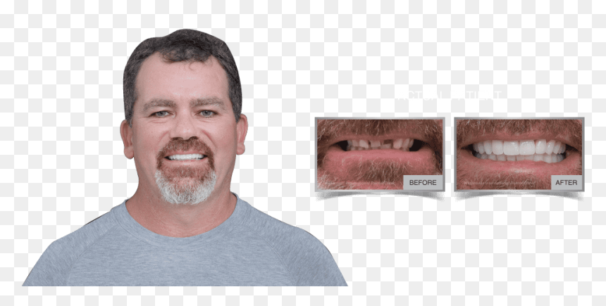 Westcoast International Dental Clinic - Human, HD Png Download - dental png