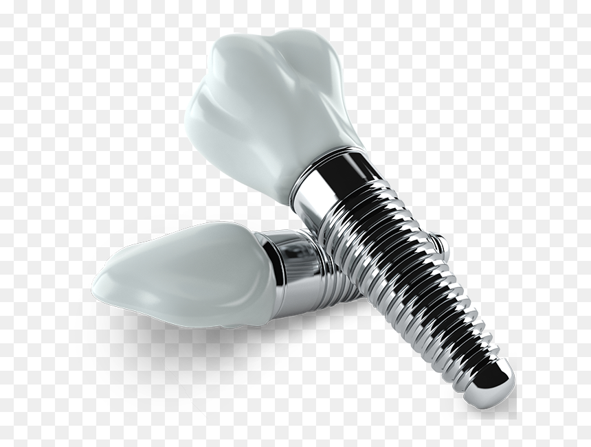 The Smile Center - Transparent Dental Implant Png, Png Download - dental png