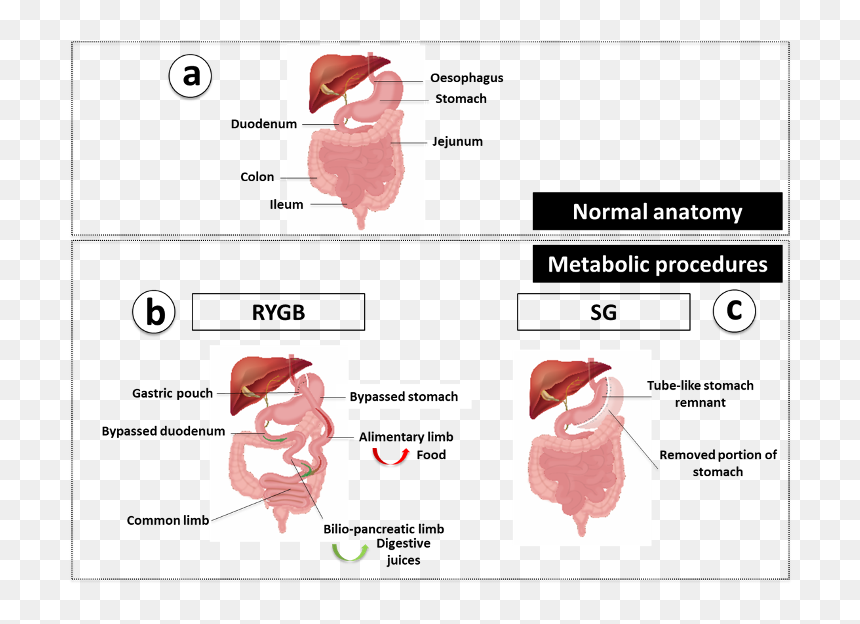 Roux En Y Hunger Benefits, HD Png Download - curved red arrow png