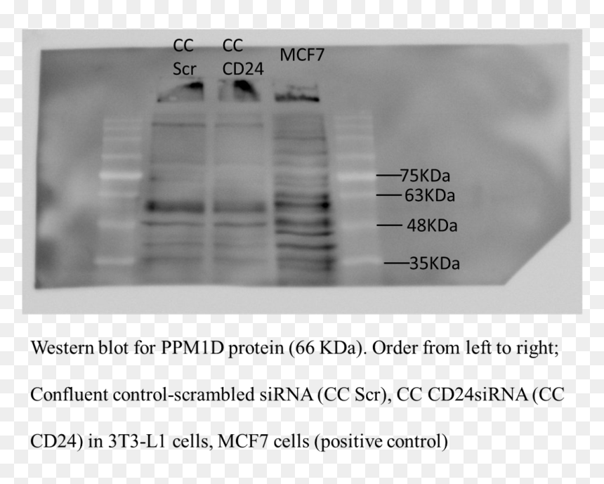 Monochrome, HD Png Download - antibody png