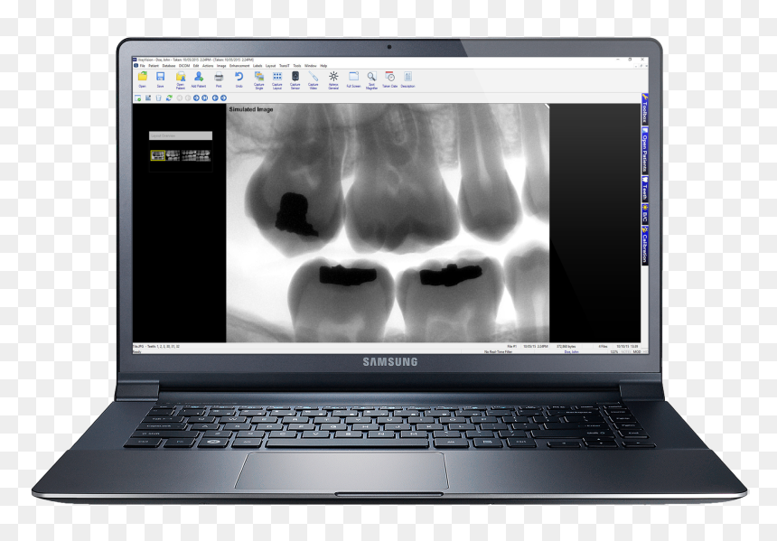 Samsung Laptop Mock Up, HD Png Download - laptop mockup png