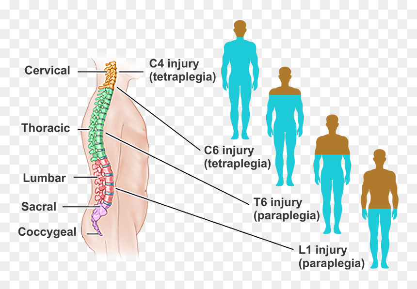 What Is Spinal Cord Injury - Spinal Cord Injury, HD Png Download - spinal cord png