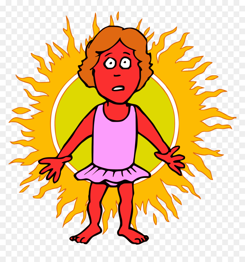 Sunburn Clipart, HD Png Download - burnt png