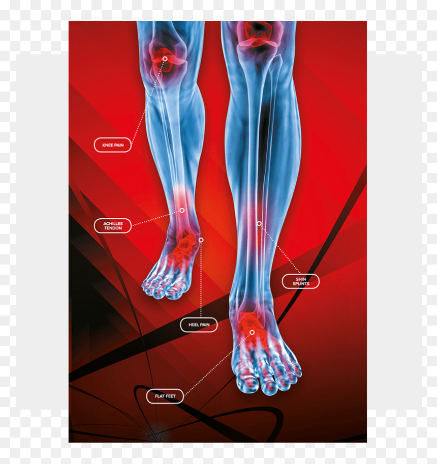 Dola Posters Skeleton - Medical Radiography, HD Png Download - skeleton arm png