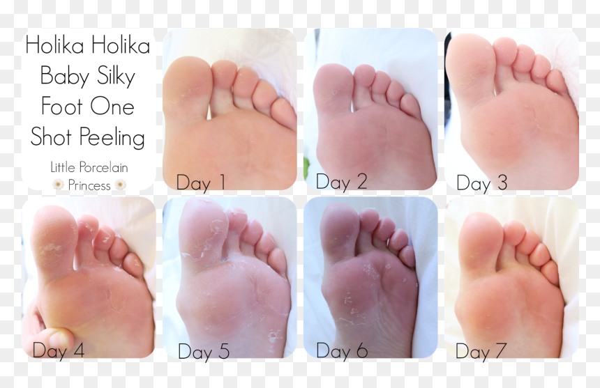 Foot Peel By Day, HD Png Download - baby foot png