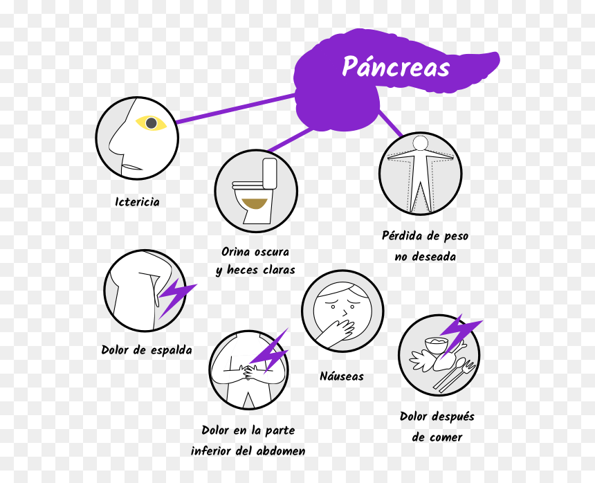 Dolor De Pancreas , Png Download - Cancer De Pancreas Sintomas, Transparent Png - pancreas png