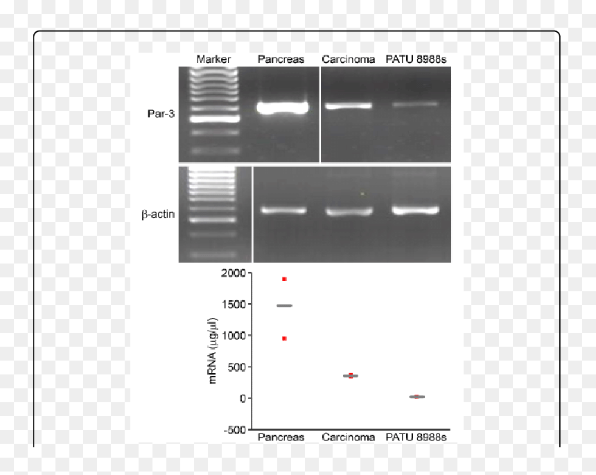 Screenshot, HD Png Download - pancreas png