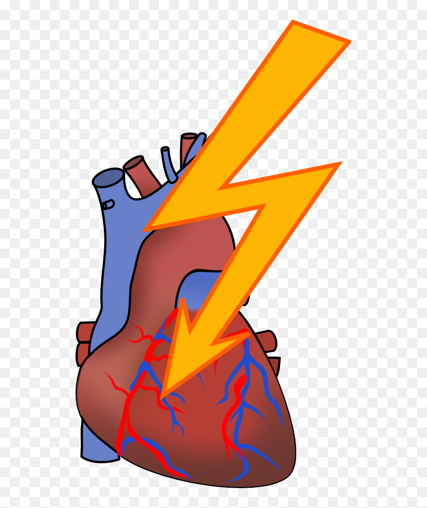 Heart Attack Clipart, HD Png Download - attack icon png