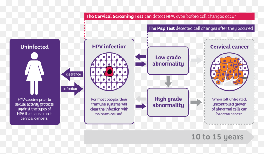 Progression Of Hpv To Cervical Cancer - Cervical Cancer Hpv Infection, HD Png Download - restroom sign png
