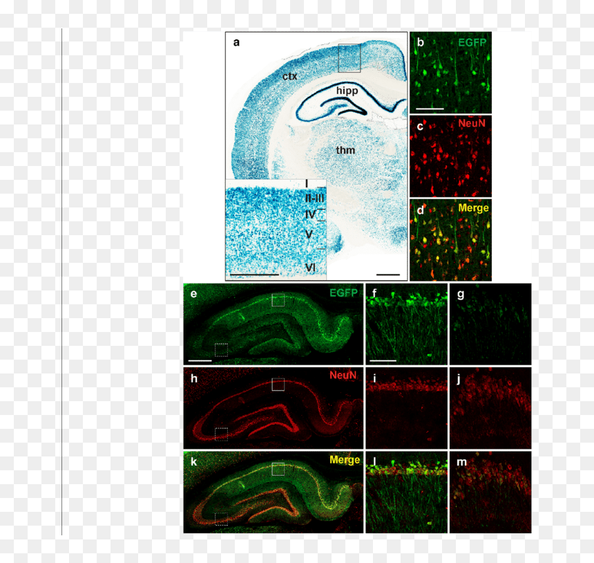 Raprnp Vector Drives Expression In Rat Neurons - Grass, HD Png Download - neurons png