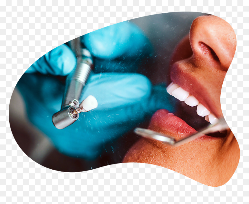 Smiles Forever Of Gardendale - Dentistry, HD Png Download - smiling mouth png