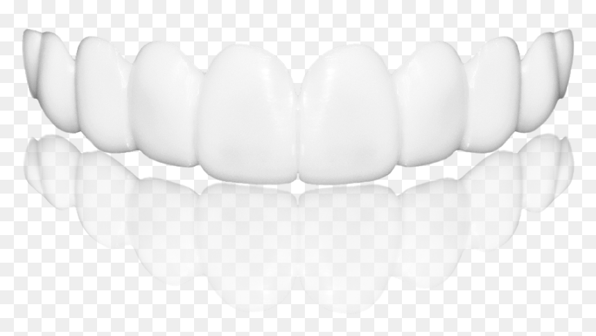 Diseño De Sonrisa Removible, HD Png Download - sonrisa png